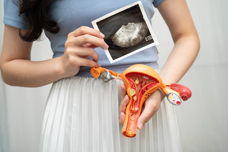 Aborto recurrente